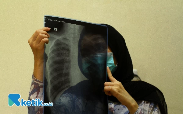 Thumbnail Arlin Nursyarifah melihatkan hasil X-ray dari rumah sakit yang menyatakan dirinya terkena ISPA akibat kabut asap, Rabu (18/10/2023). (Foto: Wahyu R/Ketik.co.id)