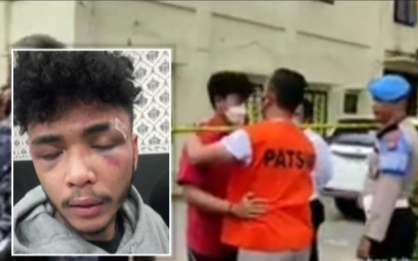 Thumbnail Ken yang Dianiaya Anak Perwira Polisi, Ternyata Pamannya Bukan Orang Sembarangan